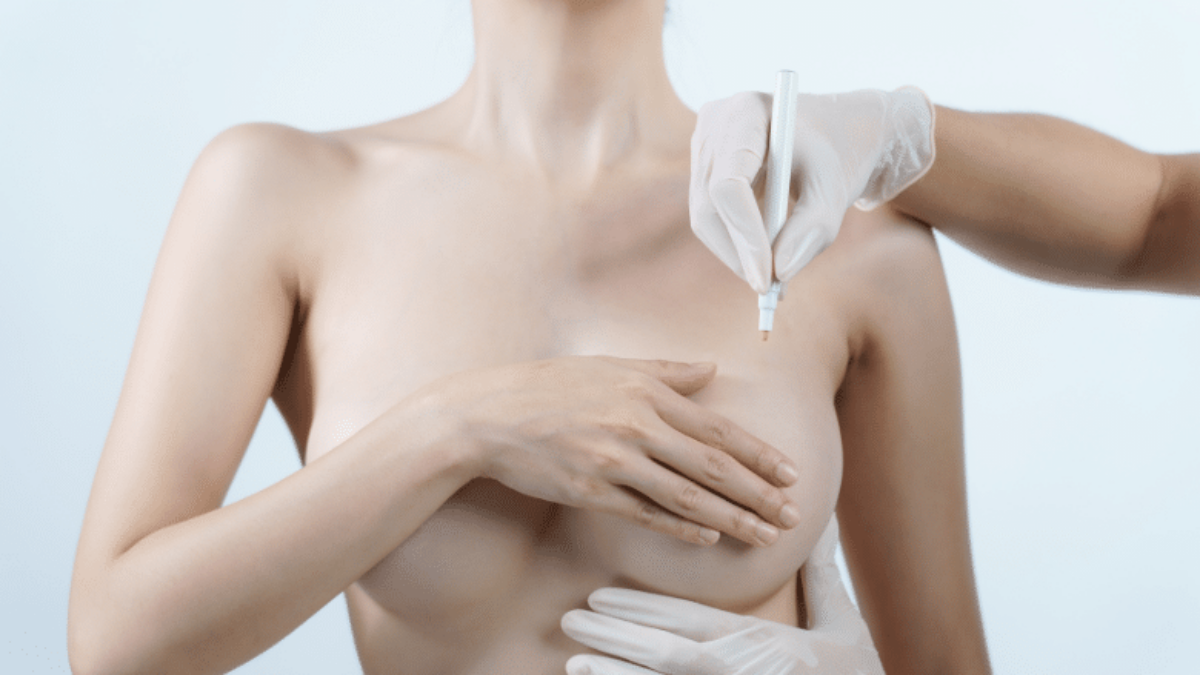 How to Fix Saggy Breasts | Centre for Surgery