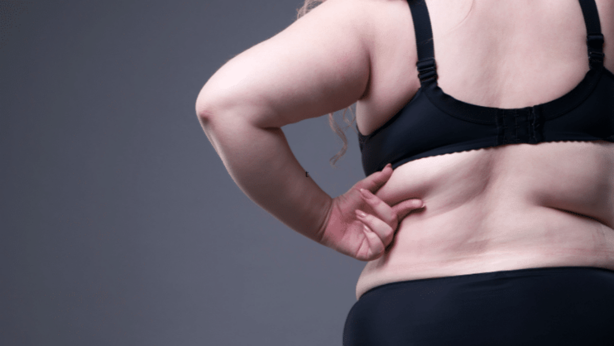 Back Fat, Why Do You Get It? And What To Do About It