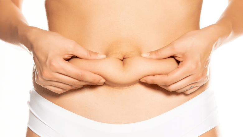 Liposuction vs Tummy Tuck For a Flatter Stomach