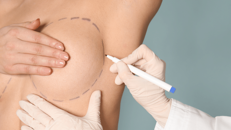 Reducing Scars After Breast Surgery