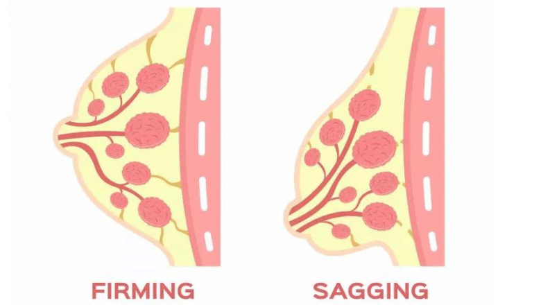 Why Do Breasts Sag