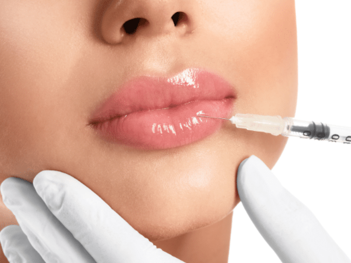Top 10 Lip Filler Shapes to Enhance Your Natural Beauty – Leva Medical