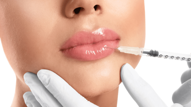 Current Popular Trends in Lip Filler Treatments