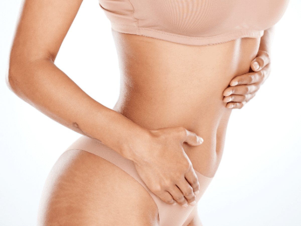Panniculectomy vs. Tummy Tuck - What are the Key Differences