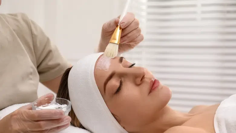 TCA Skin Peels for Brighter Skin