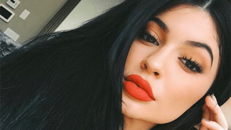 kylie jenner lip filler