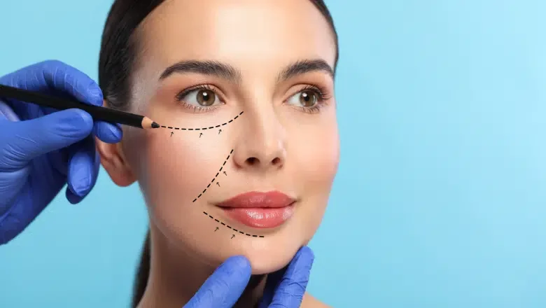 Dermal Fillers vs. Facelift Surgery