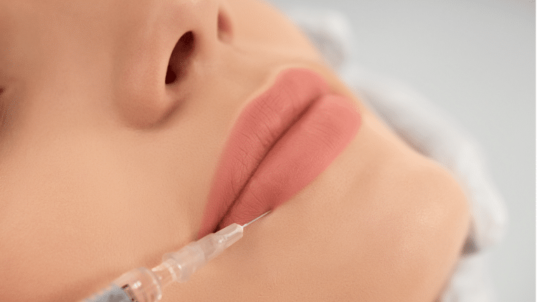 Getting Lip Filler Injections - Why Less is More