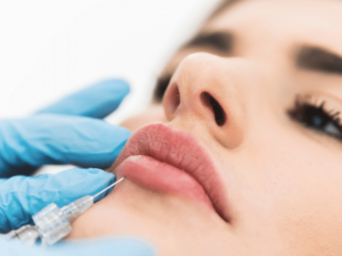 Lip Filler Swelling - How Long Does Healing Take? | Centre for Surgery