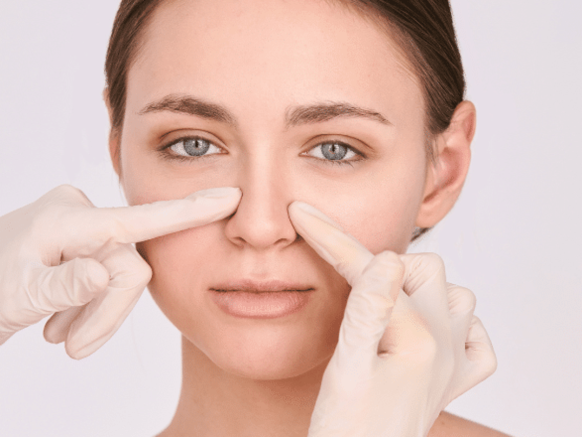 Thread Vein Removal Nose, Spider Veins on Nose