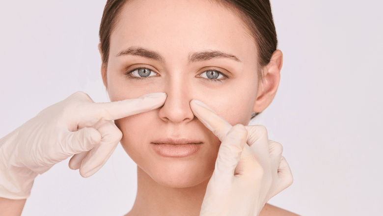 Nose Thread Vein Removal London