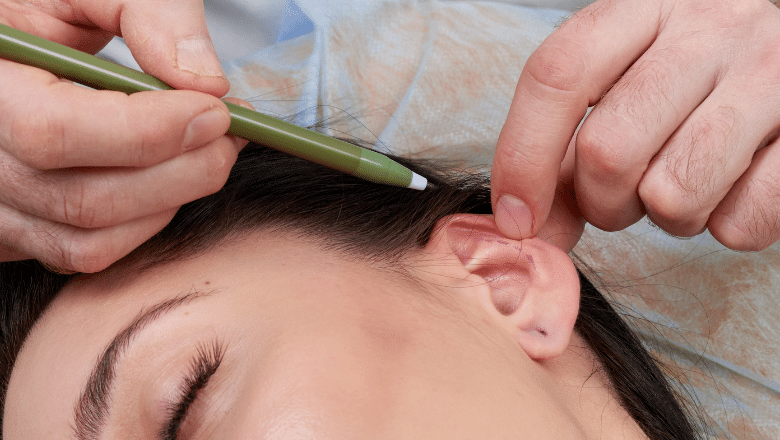 Can my Ear Shape be Corrected