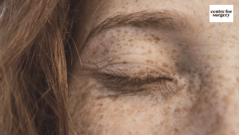 What Causes Hyperpigmentation
