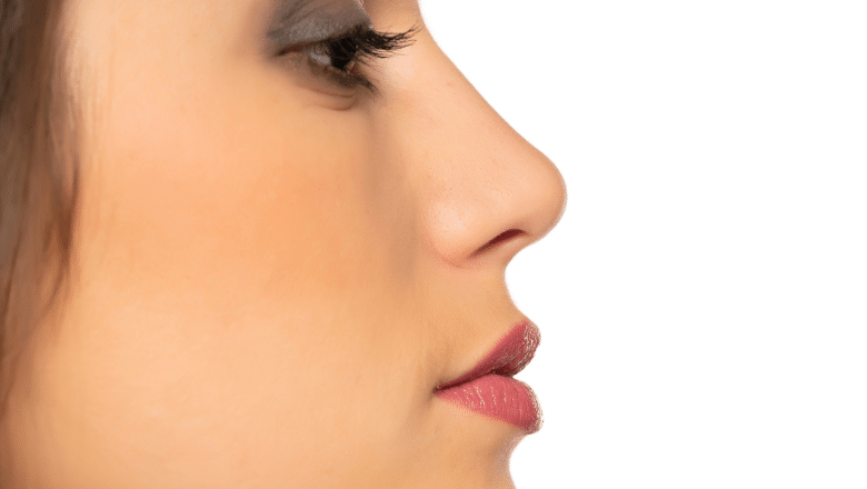 Can You Fix a Crooked Nose with Rhinoplasty