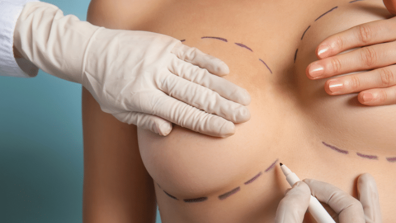 Breast Anatomy Basics What to Know Before Your Surgery