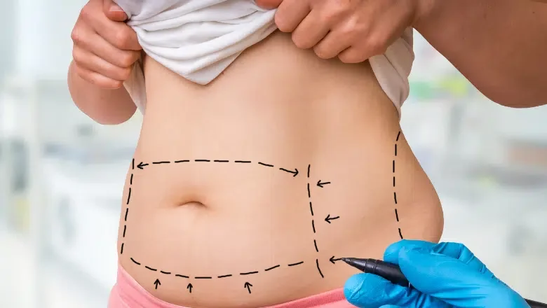 Is Ultrasonic Liposuction Better than Regular Liposuction