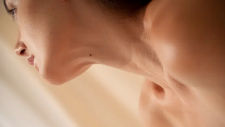 Neck Liposuction vs Chin Augmentation